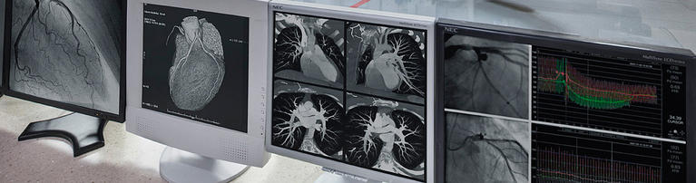 heart-vascular-diagnostics-computer-monitors-wide