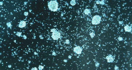 CAR - T细胞在培养中生长