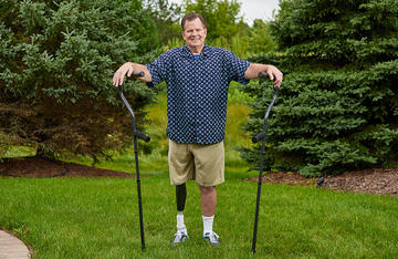 柯克·比林斯利，植入OPRA植入系统的截肢患者